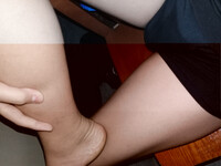 Femboy siu múp