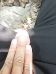 Cu bị ong đốt sưng to